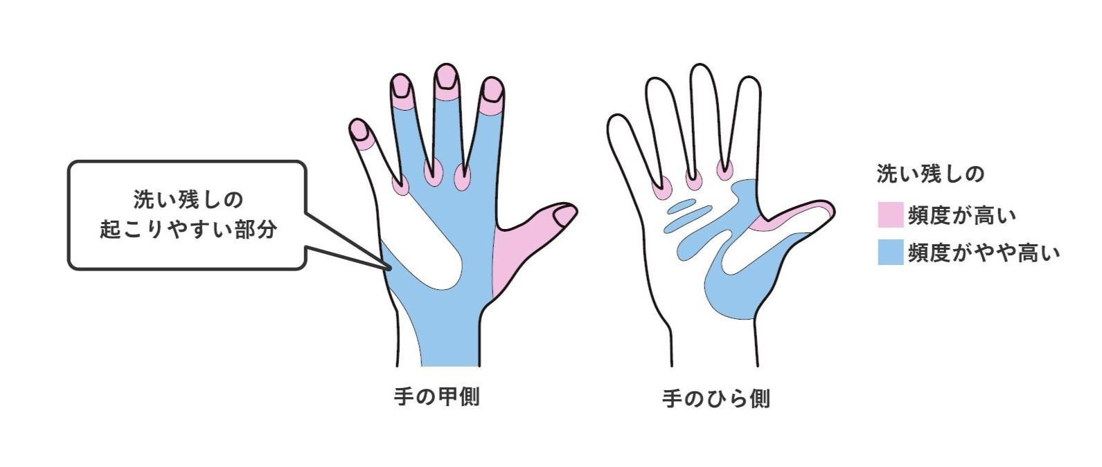 洗い残しの起こりやすい部分