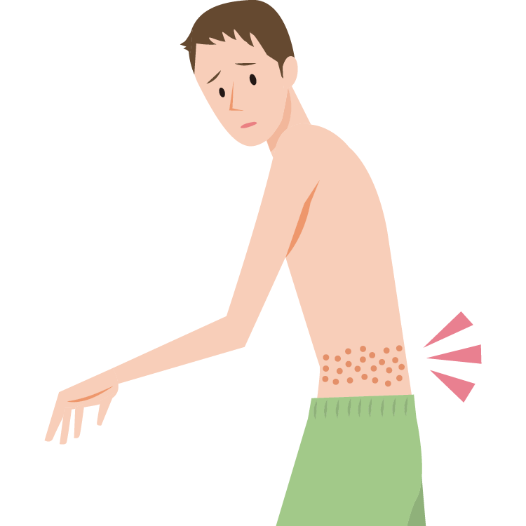 宮城 県 パチスロのウイルスが引き起こす「帯状疱疹」って何？