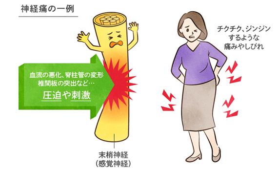 中野 パチスロ痛メカニズム