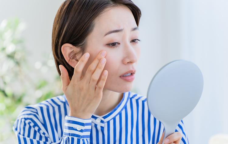 しみ・そばかす・日焼けとは？ それぞれの違いやスキンケア方法を解説