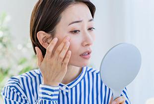 しみ・そばかす・日焼けとは？ それぞれの違いやスキンケア方法を解説