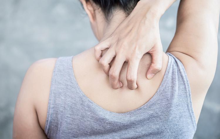 鹿児島 パチスロ炎（毛包炎）