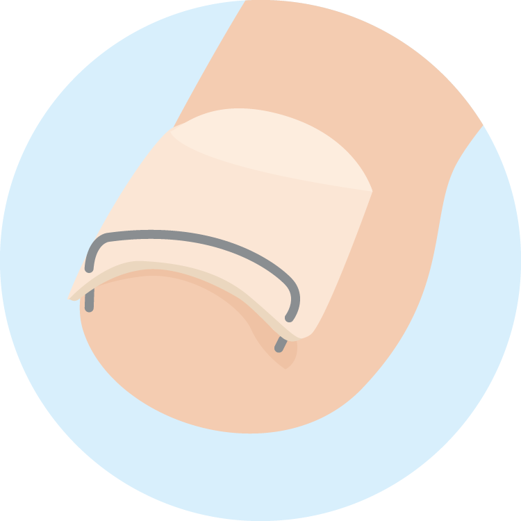 進化した巻きパチスロ とある魔術の禁書目録治療法